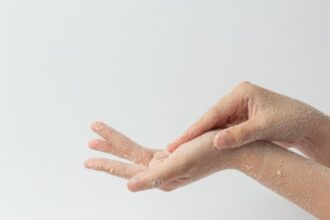 ilustrasi kulit tangan kering