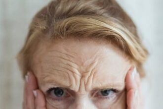 Ilustrasi kerutan di dahi/keriput.