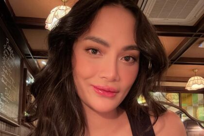 Prihatin, Begini Kondisi Terkini Erika Carlina, Kepala Sampai Botak