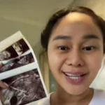 Denise Chariesta Cari Donor Sperma Rp100 Juta, Kini Ungkap Rencana Bayi Kembar